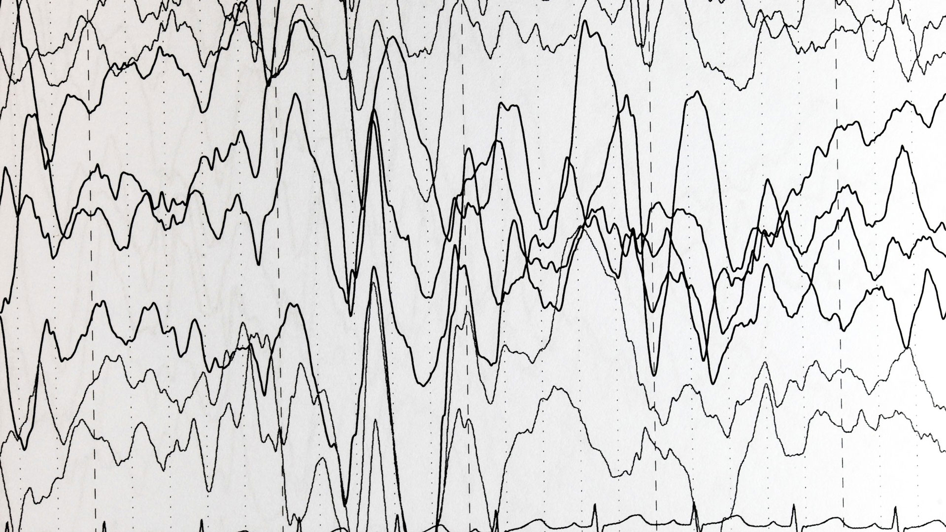 Padrões de ondas cerebrais