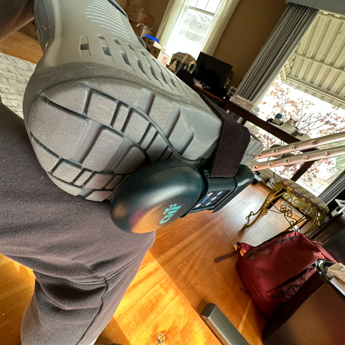 Troy's Fractures