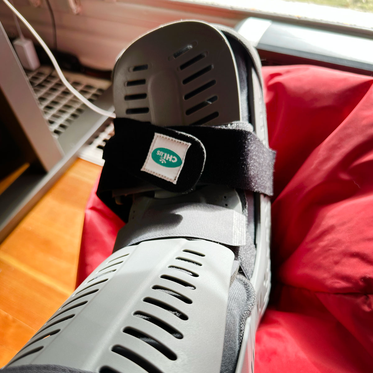 Troy's Fractures