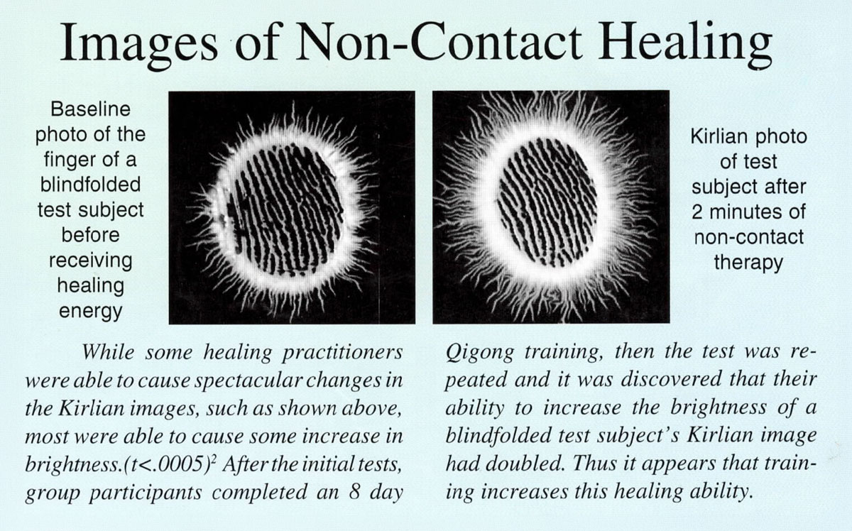 Images of Non-Contact Healing